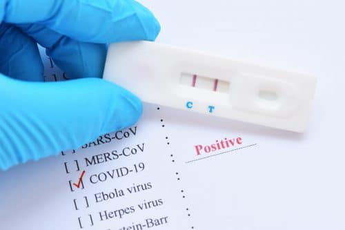 Are you Using Hand Sanitiser? MBMD