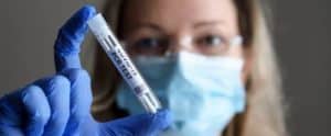 MBMD Antigen Fit to fly kits Test Herpes Kit MBMD