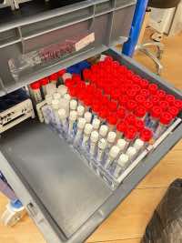 5 Million – On the rise: a vaccine is being studied MBMD