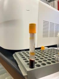 Do you have a story to tell about syphilis? MBMD