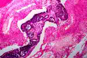 I’m about to collapse and I need to lie down! MBMD