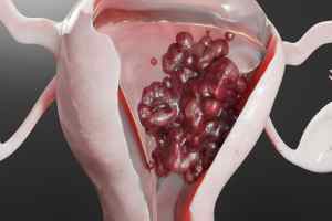 Recurances taught me not to continue if I am tired? MBMD