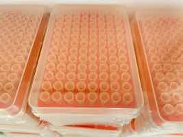 A huge given is the rising rates of oral cancers in escorts MBMD