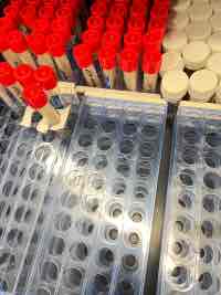 I love my boyfriend so much that I can’t be intimate MBMD