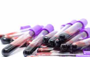 Do you check the information given by the doctor or MBMD