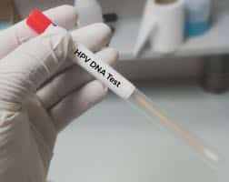 A prolapse, does it reach the entrance to the vagina? MBMD